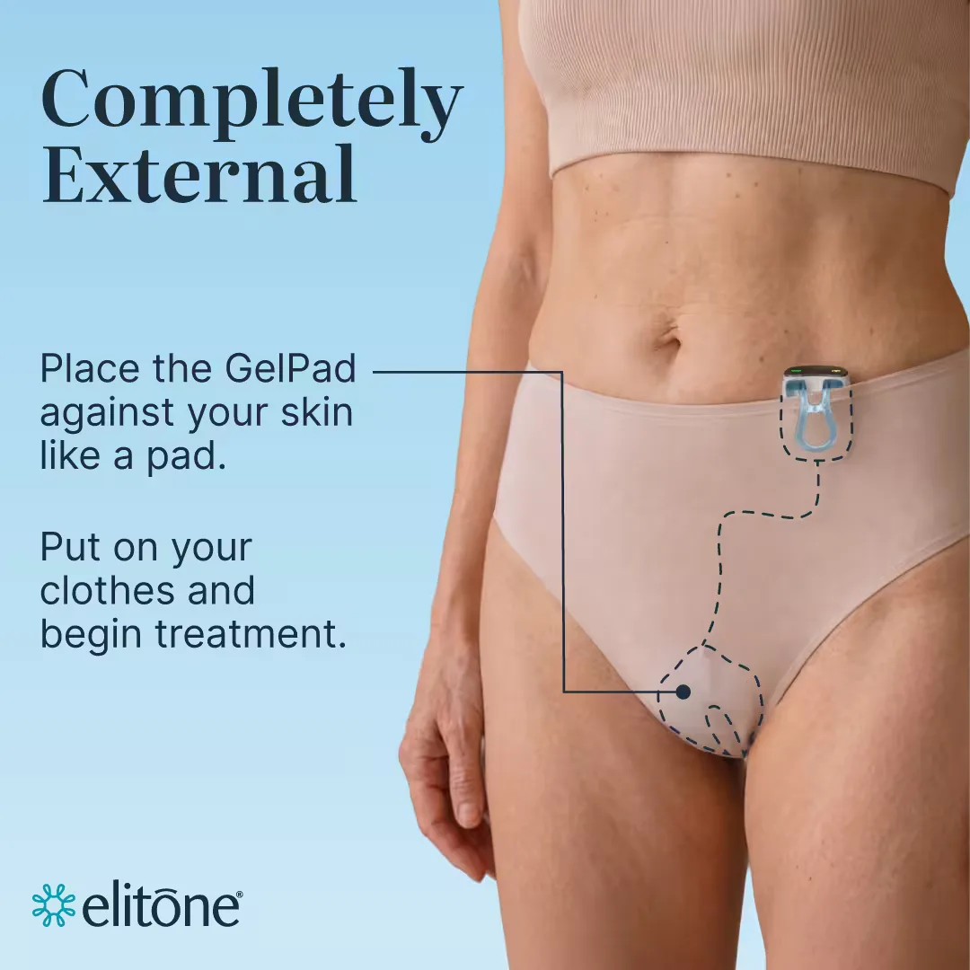 Elitone is completely external: the GelPad sits against your skin like a pad and the controller clips to your waistband