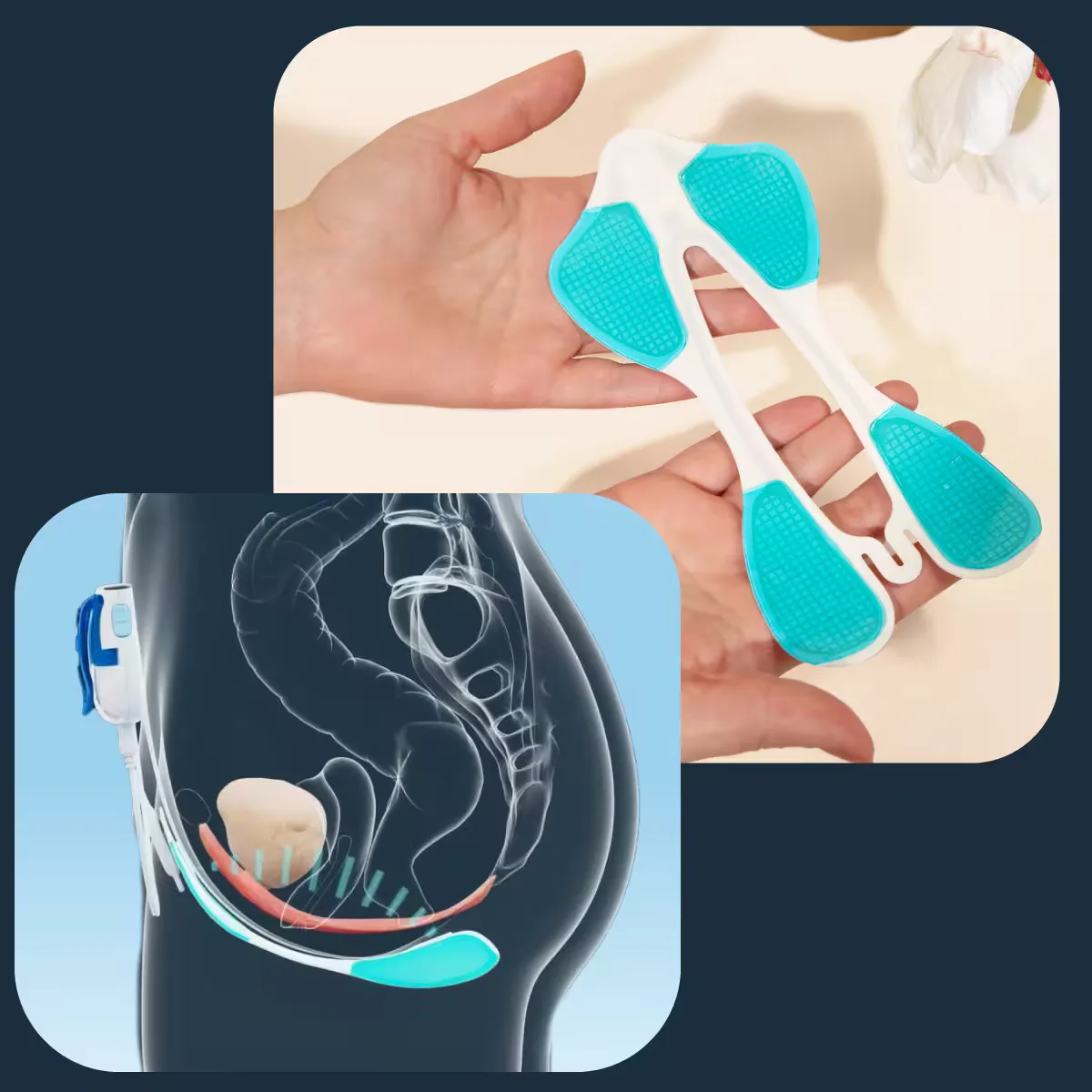Elitone GelPad held in hand, with a diagram of where it sits on the pelvic floor
